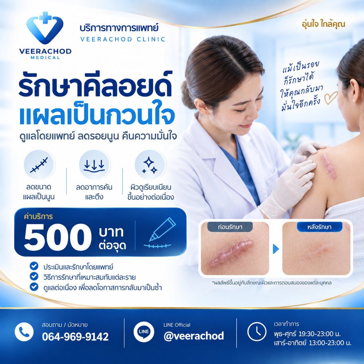 รักษาคีลอยด์ 500 บาท ต่อการฉีด 1 จุด — วีรโชติ คลินิกเวชกรรม